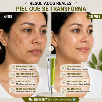 Retinal – Combate Manchas, Líneas y Piel Desgastada